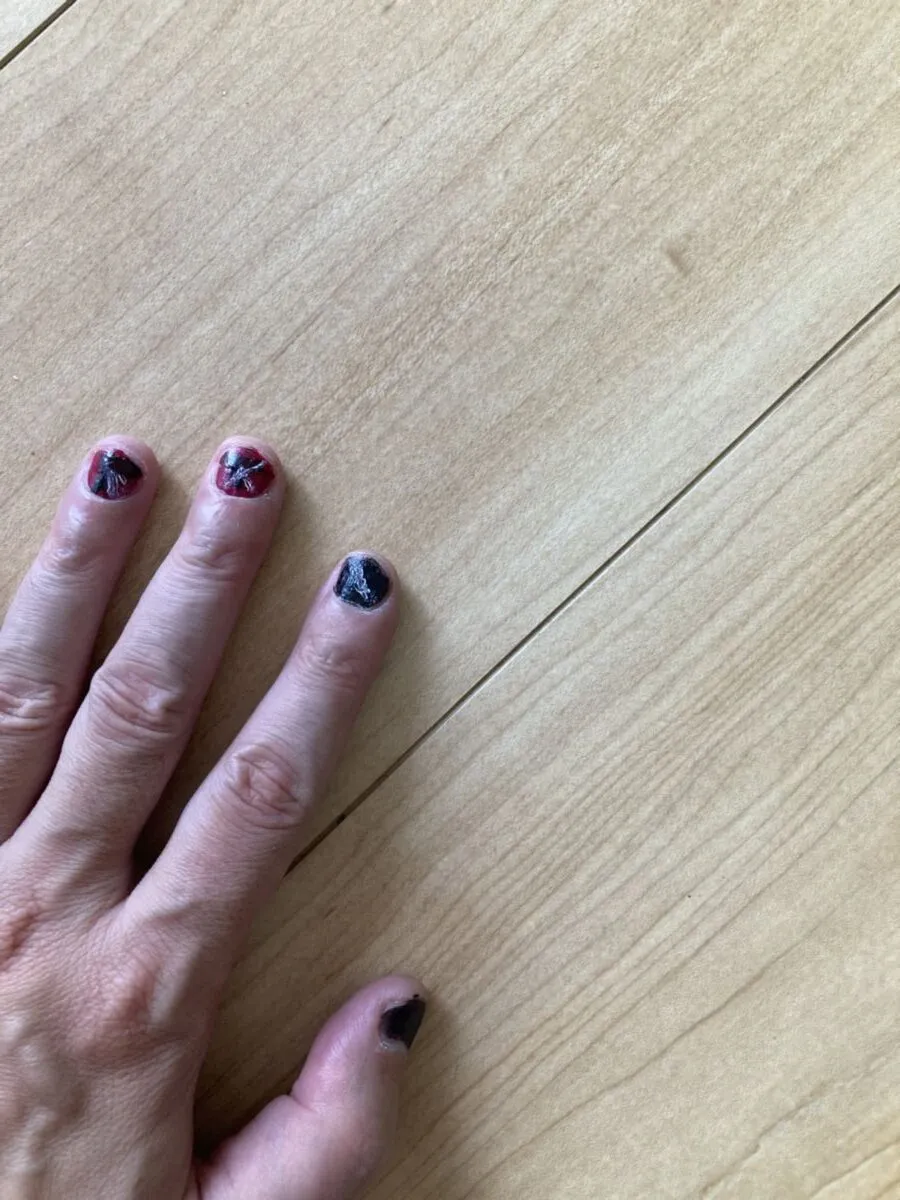 「写真の説明」ゾンビネイルの写真